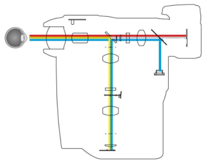 眼底照相机 工作原理图