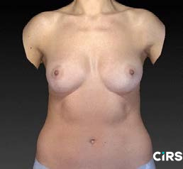 化妆品,功效评价,VECTRAH2 3D,医美