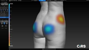 化妆品,功效评价,VECTRAH2 3D,医美