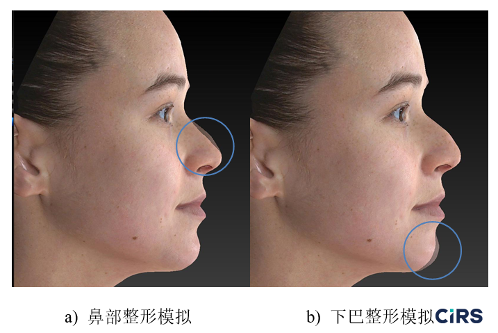 化妆品,功效评价,VECTRAH2 3D,医美
