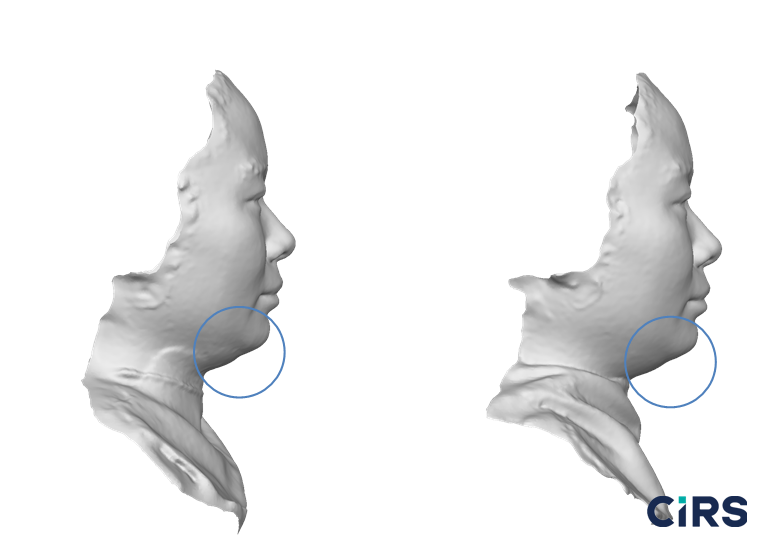 化妆品,功效评价,VECTRAH2 3D,医美