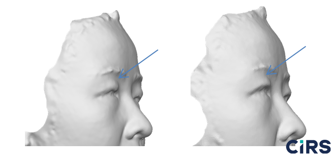 化妆品,功效评价,VECTRAH2 3D,医美