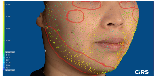 化妆品,功效评价,VECTRAH2 3D,医美