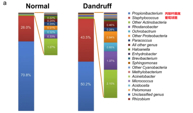 头皮,健康,头皮脱屑,头皮皮脂