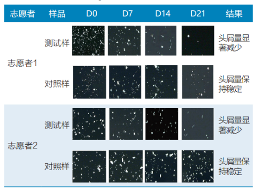头皮,健康,头皮脱屑,头皮皮脂