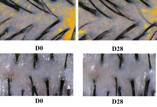 头皮,健康,头皮脱屑,头皮皮脂