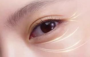 Efficacy Evaluation and Practical Cases - Tear Troughs and Lacrimal Grooves Evaluation 