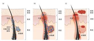 敏感肌,皮肤,敏感